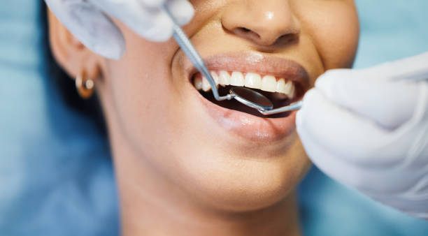 Best Emergency Wisdom Teeth Removal in Elk Mound, WI