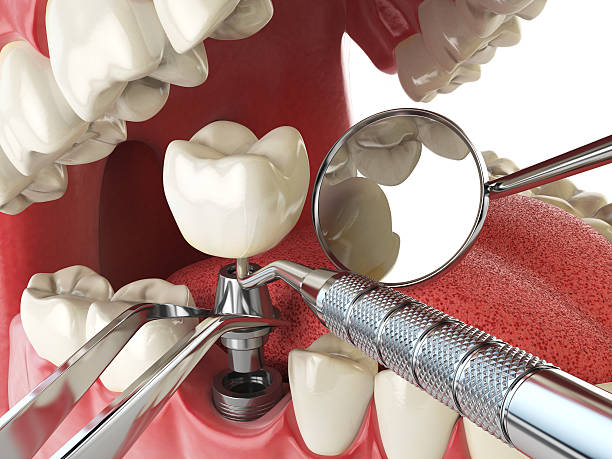 Best Emergency Treatment for Dental Infections or Abscesses in Elk Mound, WI