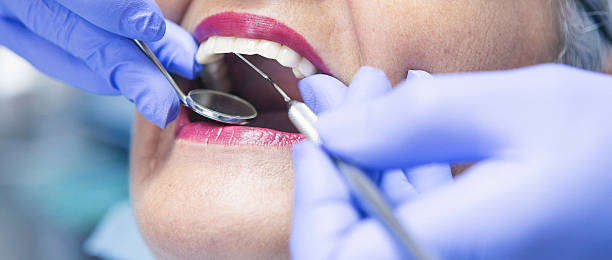 Best Urgent Care for Lost Fillings or Crowns in Elk Mound, WI
