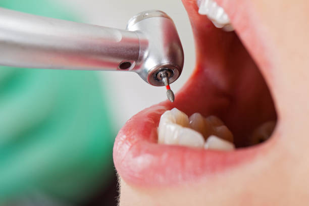 Best Emergency Dental Care for Broken or Chipped Teeth in Elk Mound, WI